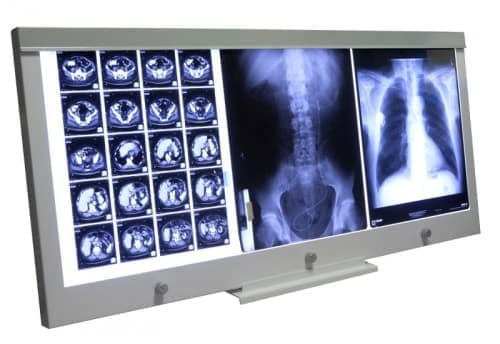 Negatoskop LED NGP 31 mocowanie ścienne - producent Ultra-Viol