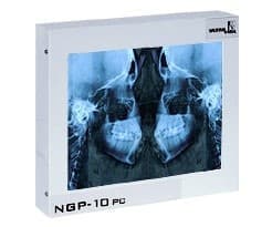 Negatoskop dentystyczny CEFALOM 01 serii NGP - producent Ultra-Viol
