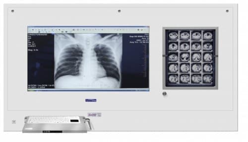 Stacja cyfrowa na salę operacyjną DICO 1M/1B - producent Ultra-Viol