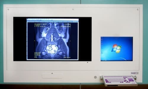 DICO 2M 47"/21" cyfrowy komputer medyczny (wersja do wbudowania w ścianę) - producent Ultra-Viol