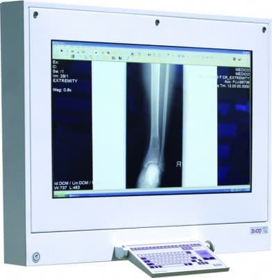 DICO 2M 47"/21" cyfrowy komputer medyczny - producent Ultra-Viol