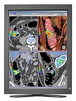 Eizo RadiForcee RS210 21" monitor 2 MPix kolorowy - producent Ultra-Viol