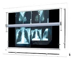 Negatoskop żaluzjowy do mammografii NGP-41 mZU - producent Ultra-Viol