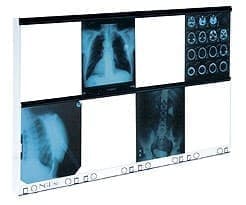 Negatoskop dwuklatkowy NGP 80 - producent Ultra-Viol