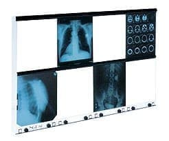 X-ray film viewer NGP-81