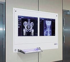 stacja przeglądowa na salę operacyjną Dico - producent Ultraviol